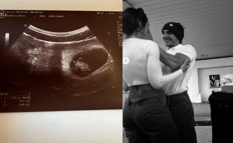 Miguel Herrán publicou no seu Instagram uma imagem de ultrassom do bebê